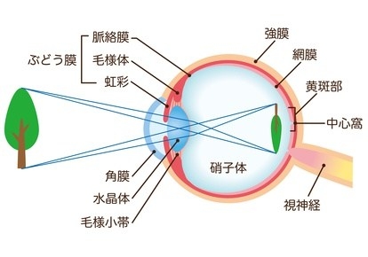 屈折異常 屈折異常