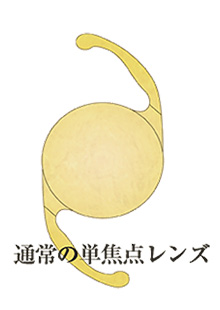 単焦点眼内レンズ