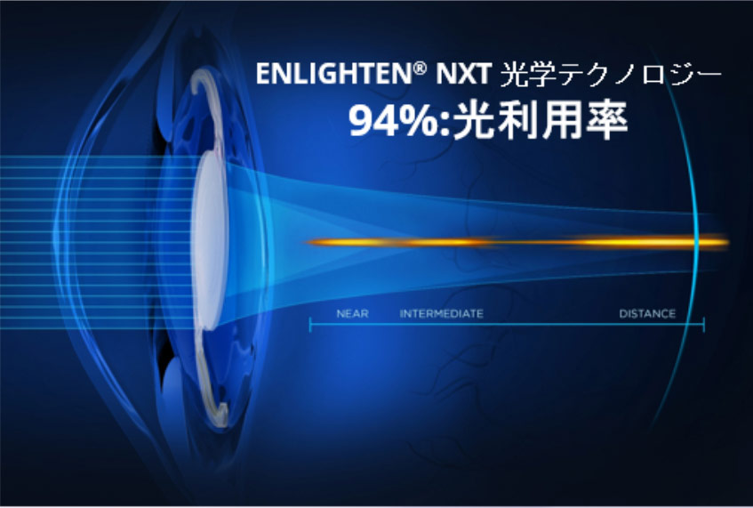 NXT光学テクノロジー」